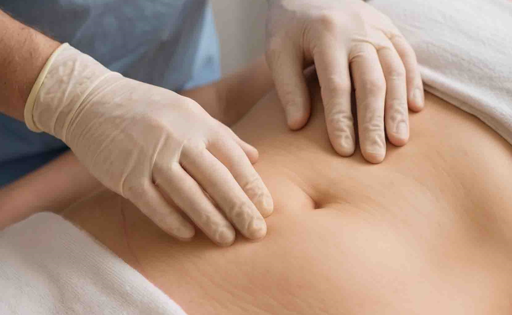 Imagen de drenajes linfáticos tras abdominoplastia.